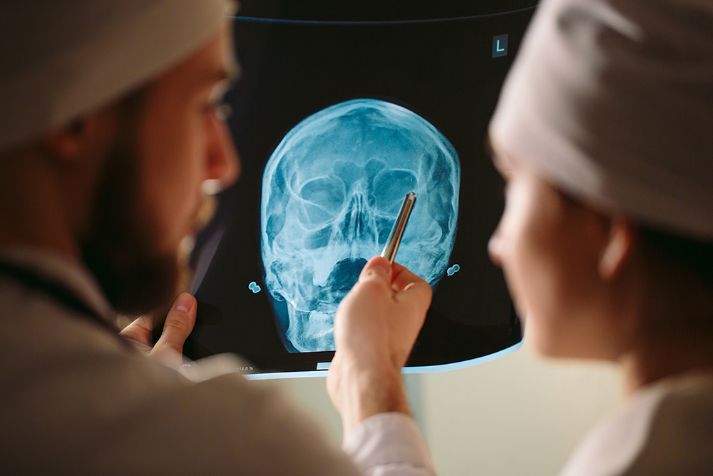 two doctors looking at an x-ray of the brain